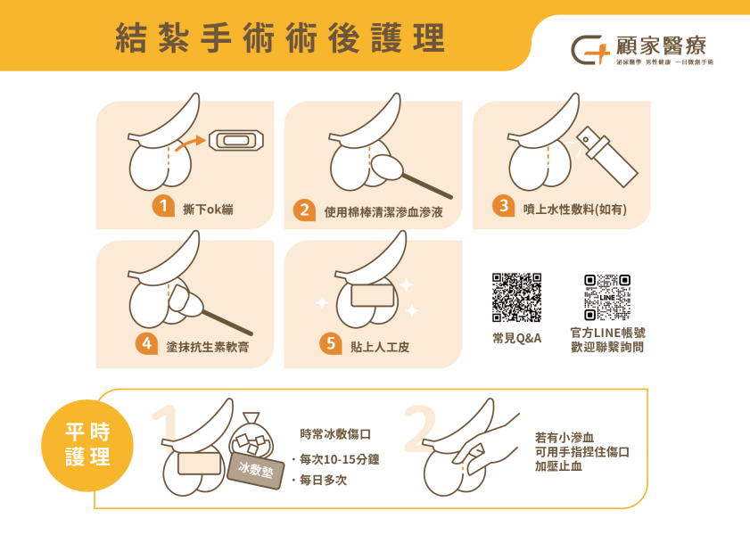男性結紮術後照護