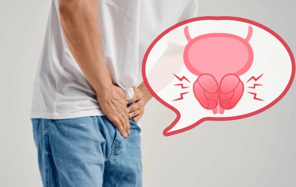 攝護腺發炎