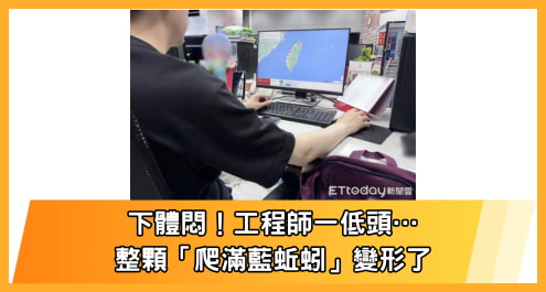 下體悶！工程師一低頭…整顆「爬滿藍蚯蚓」變形了