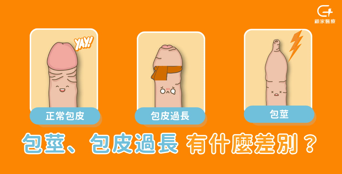 包莖和包皮過長差別