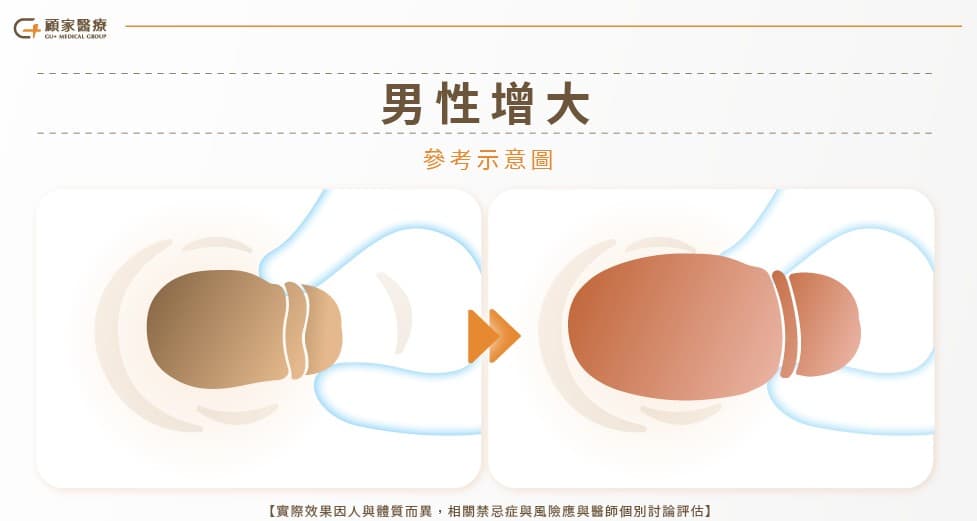顧家醫療男性真大示意