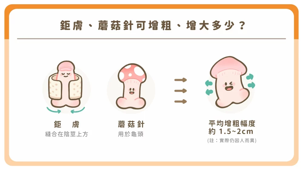 鉅膚、蘑菇針(異體真皮)可增粗、增大多少?