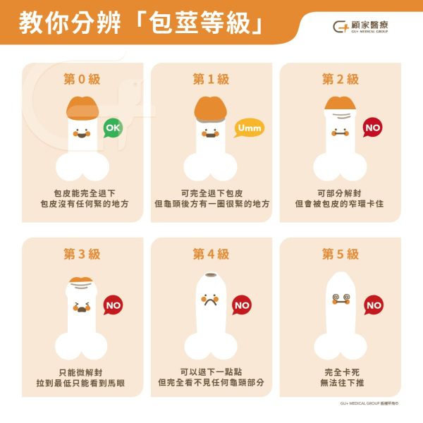 怎樣算包莖?包莖等級一次看