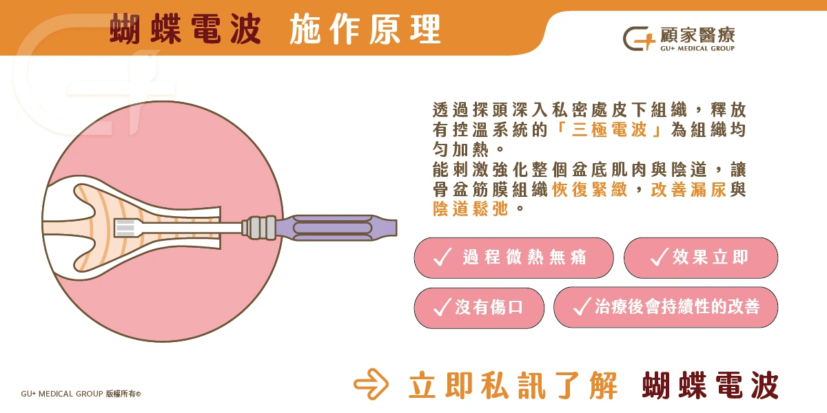改善鬆弛-蝴蝶電波