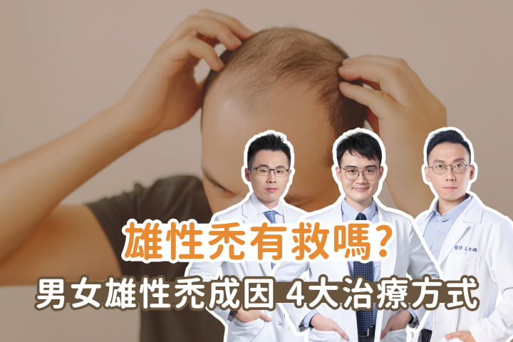 雄性禿有救嗎? 男女雄性禿成因 4大治療方式