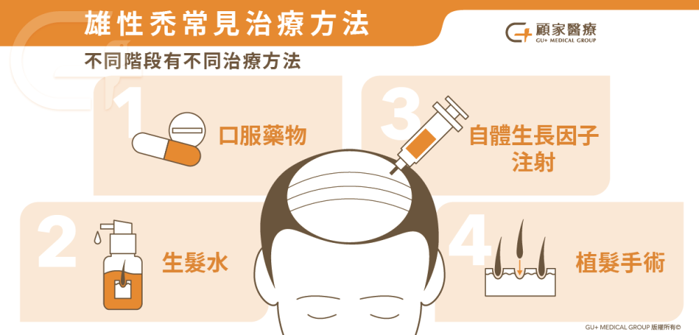 雄性禿治療方法