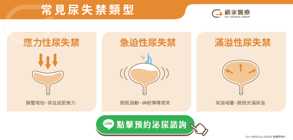常見尿失禁類型